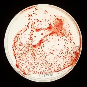 rhodobacter-duoi-kinh-hien-vi
