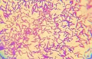 bacillus-subtilis-suc-manh-cua-truc-khuan-trong-nuoi-trong-thuy-san-3-300x193